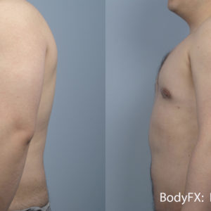 Redukcja tkanki tłuszczowej BodyFX