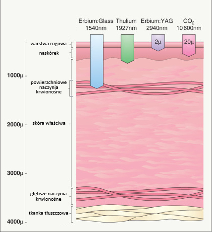Głębokość działania laserów frakcyjnych
